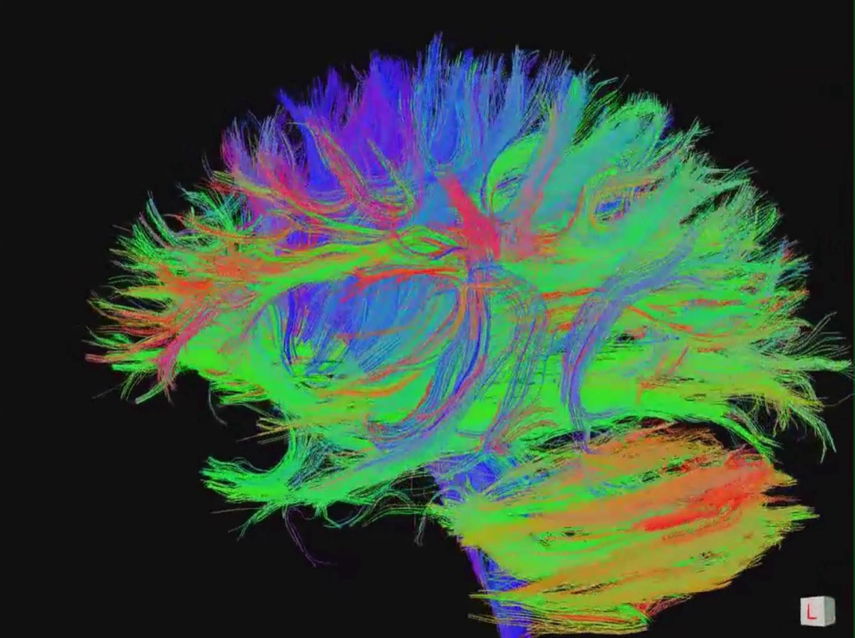 Brain connectivity visualization — super-resolution for connectomics